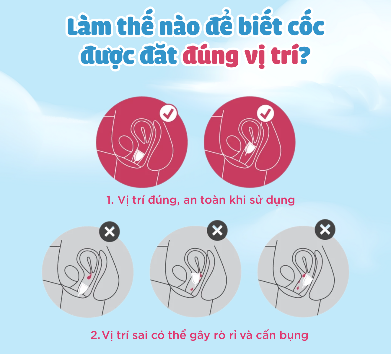 [Cốc Nguyệt San Size B 35ml] Silicone Y Tế Cao Cấp | Cốc Nguyệt San Thế Hệ Mới Eunali Chính Hãng